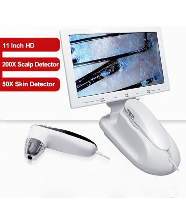 Hair Follicle Detector 11 Inch 200X High-Definition Skin Detector 1080P Imaging Used to Detect the Health Status of Scalp Hair Follicles and Skin - Buy Online on GoSupps.com