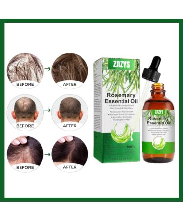 Rosemary Oil For Hair Growth (UK Company) Organic Rosemary Oil With Applicator Bottle - Buy Online on GoSupps.com