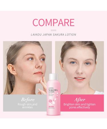 Sakura Face Lotion & Toner - Hydrating Essence for Shrink Pores Daily Skin Care with Vitamin C Moisturizing Facial Cream & Softener - Buy Online on GoSupps.com
