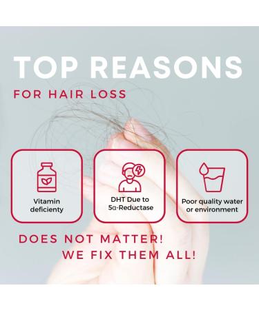 Advanced Potent Lion's Flow Hair Regrowth Supplement - Natural DHT Blocker for Thicker Fuller Hair | Fast-Acting & Clinically Proven Hair Loss Treatment (2-Month Supply - Buy Online on GoSupps.com