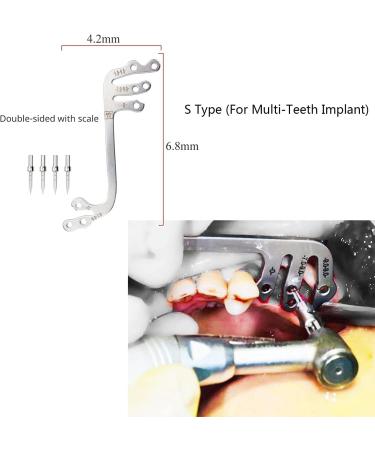 JMYSD Dental Implant Guide Set | Orientation Aid & Punch Pliers for Dentists | Precision Dental Tools for International Shipping - Buy Online on GoSupps.com
