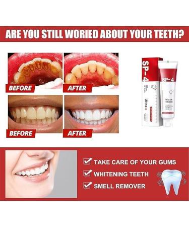 SP-4 Brightening & Stain Removing Toothpaste - Probiotic Whitening Natural Teeth Whitener (2 Pcs) - International Shipping Available - Buy Online on GoSupps.com