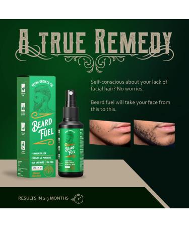 Beard Growth Serum 5% Minoxidil with Biotin - 2 Fl Oz (Pack of 1) - Buy Online on GoSupps.com