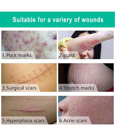 Effective Stretch Marks & Scar Removal Cream | Skin Repair Formula for All Skin Types - Buy Online on GoSupps.com