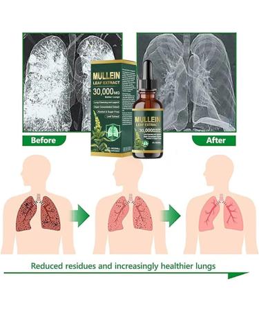 Gouttes d'extrait de feuille de mol ne bio nettoyantes pour poumons extrait de mol ne pour poumons formule naturelle nettoyage et soutien respiratoire convient pour homme et femme (1 pi ce) 1 Pi ce. - Buy Online on GoSupps.com