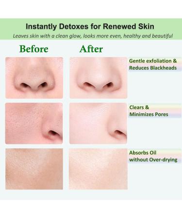Purifying Green Tea Clay Stick Mask for Blackhead Removal - Anti-Acne, Oil Control & Pore Cleansing for All Skin Types - Men and Women - Buy Online on GoSupps.com