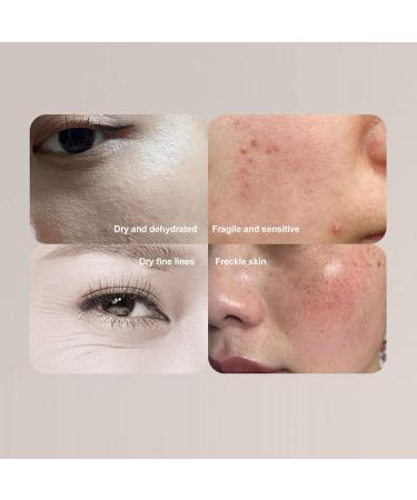 Facial Skin Tester Portable Skin Analyzer USB Facial Moisture Meter Skin Care Water Oil Tester Digital Moisture Sensor for Beauty Salon - Buy Online on GoSupps.com