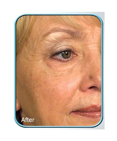 Buy Biologic Stem Cell Wrinkle Therapy - Set of 2 | Anti-Aging Skincare for Global Shipping - Buy Online on GoSupps.com