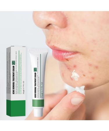 Anti Acne Face Cream Spot Cream for Acne Treatment and Spot Treatment with Nicotinamide Sodium Hyaluronate Aloe for Blackheads and Acne Prone Skin Reduces Spot Size Redness and Inflammation - Buy Online on GoSupps.com