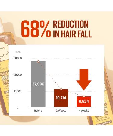 CRAZY SKIN Beer Shampoo & Hair Pack SET - Biotin Rich for Hair Loss, Regrowth & Thickening - Sulfate-Free Formula - Buy Online on GoSupps.com