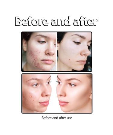asmine Gentle Facial Cleanser - Pore Cleansing Face Wash Spot & Acne Reducing Refreshing Formula for Smooth & Delicate Skin Suitable for All Skin Types - Buy Online on GoSupps.com