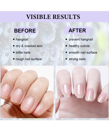  LOPHE LOPHE Set of 3 nail and cuticle oils with dropper for repair and hydration of hands and feet 15 ml - Buy Online on GoSupps.com