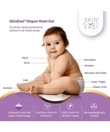 Tariba Baby Windeland Gel | Clinically Proven NAPI Gel for Newborns | Heals & Prevents with Marigold Lavender Patchouli Oils & Vitamin E | 25g Pack - Buy Online on GoSupps.com