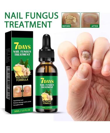  Cymwer Ginger Nail Serum 30ml Natural Growth Oil Strengthener for Fortified Nails Moisturizing and Revitalizing Care - Buy Online on GoSupps.com