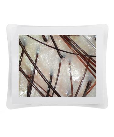 Skin Diagnosis Hair Analyzer 50X 200X Magnification Clear Display High Definition 17inch Screen Skin Follicle Detector for Beauty Salon (US Plug)