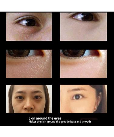 Repairing Eye Cream & Moisturizing Eye Oil Granules - Anti-Aging Serum for Dark Circles & Eye Care (15ml) - Buy Online on GoSupps.com