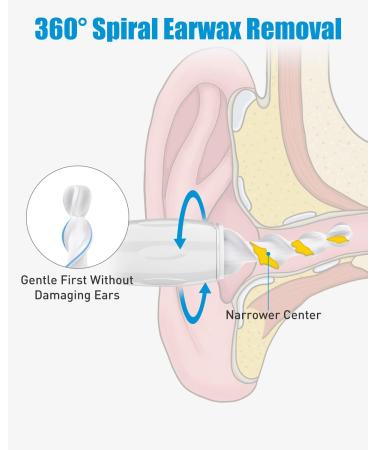 2023 New Safe & Effective Ear Wax Removal Kit - 360 Spiral Q Grip Tool with 8 Tips - Soft Silicone for Adults, Kids & Teens - Washable & Reusable - Buy Online on GoSupps.com