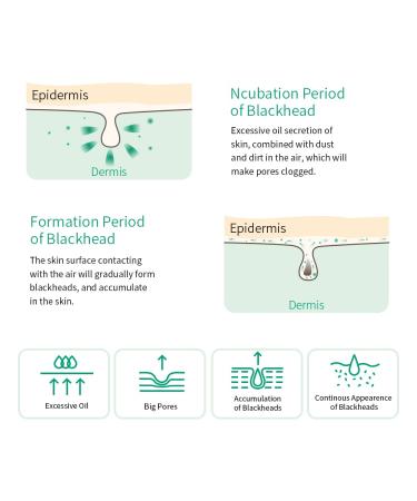 Breylee Blackhead Mask with Tea Tree Oil for Deep Cleansing - 100 Pcs Strip Paper Included - Buy Online on GoSupps.com