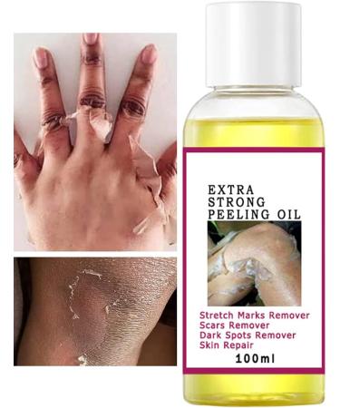 Yellow Peeling Oil Old Yellow Scrub Oil Exfoliating Oil for Dark Skin Dark Sports Remover Suitable for Hands and Feet - Buy Online on GoSupps.com