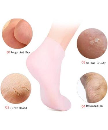 kawehiop Toe Socks with Soft Silicone Gel for Foot Care Cushioned and Supportive Skin M 1Set 1Set Skin M - Buy Online on GoSupps.com