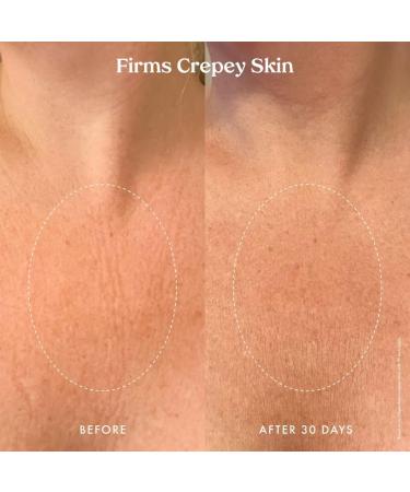 Kopari Ultra Renewal Retinol Body Cream Infused with Acai & Encapsulated Retinol Treat Fine Lines & Crepey Skin Resurface & Boosts Collagen 4.7 oz - Buy Online on GoSupps.com