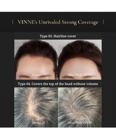 Vinne 2-Color Hair Cushion Stick - Waterproof Gray Cover & Long-Lasting Root Filler | Natural Black & Dark Brown Hair Concealer (0.04 oz - Buy Online on GoSupps.com
