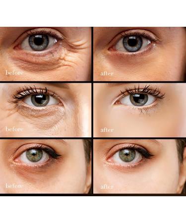 Garwar Retinol Caffeine Eye Cream 2pcs - Anti-Wrinkle & Hydrating Eye Treatment for Dark Circles & Puffiness - Buy Online on GoSupps.com