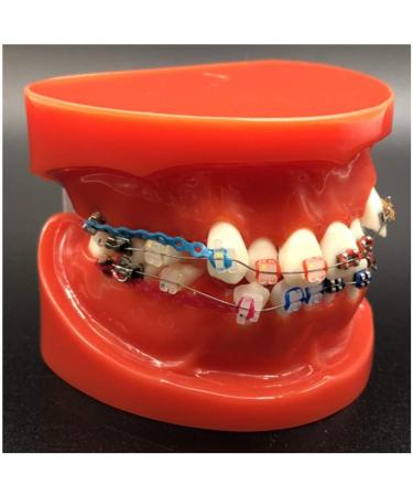 Dytah Toothpodont - Orthodontic Teeth Model with Mental Brackets & Ligature Ties | Red Study Tool for Teaching & Learning - Buy Online on GoSupps.com