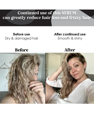 Biotin Hair Growth Treatment & Thermal Protectant Serum - High Potency Anti Hair Loss Styling Serum for Dry & Damaged Hair - UV Protectant - 4oz - Buy Online on GoSupps.com