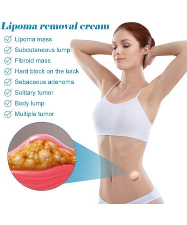 Buy FENGYANG 2PCS Lipoma Removal Cream - Herbal Solution for Lipom Lumps & Lymphatic Detox - Buy Online on GoSupps.com