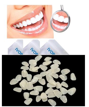 IVORIE Ultra Thin Whitening Veneers Resin Teeth Upper Anterior 50PCS (A2) - Cosmetic Dental Solution - Buy Online on GoSupps.com