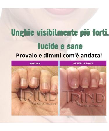  ENHANCEMENTS Nail strengthening healing kit | Nail Repair + Nail Balsam + Remover | Nails damaged by semi-permanent gel | Repairs hydrates protects | the three beautiful things. - Buy Online on GoSupps.com