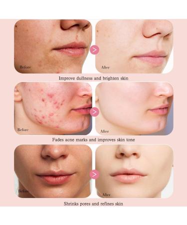 Peach 70 Niacinamide Serum Dark Spot Correcting Serum for Face Hydrating Facial Serum for Oily Skin Daily Clean - Buy Online on GoSupps.com