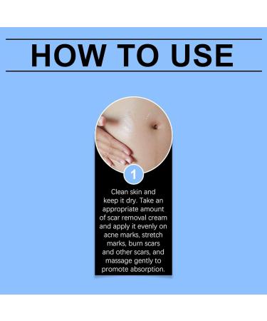 Scar Removal Fade Stretch Marks 30g Gel Reduces Stretch Marks Keloids Surgical Wounds Injuries Cesarean Section New and Old Scars - Buy Online on GoSupps.com