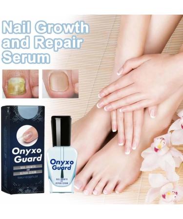 OnyxoGuard Nail Growth and Repair Serum Serum Nail Strengthener Nail Strengthening and Growth for Thin Nail Brittle & Damaged Strengthener Base Coat Nail Polish Repair Nail Growth Treatment (2Pcs) - Buy Online on GoSupps.com