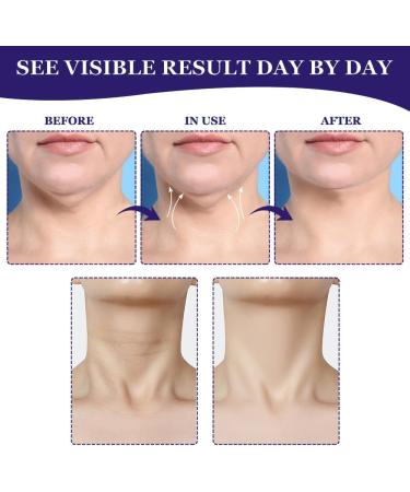 Fengyang 2Pcs Neck Cream Neck Firming Cream Neck Firming Cream Neck Moisturizing Cream for Firmer and Wrinkle-Free Neck - Buy Online on GoSupps.com