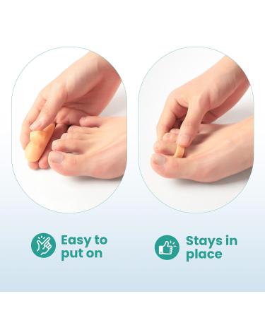 Welnove Hammer Toe Corrector & Straightener - 8 Pcs Toe Support Pads for Realigning Bent Curled & Hammer Toes - Optimal Comfort & Alignment - Buy Online on GoSupps.com