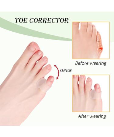 10 Pieces Silicone Toe Spreader - Gel Separator for Overlapping & Hammer Toes Pain Relief - Unisex Solution for Comfort - Buy Online on GoSupps.com