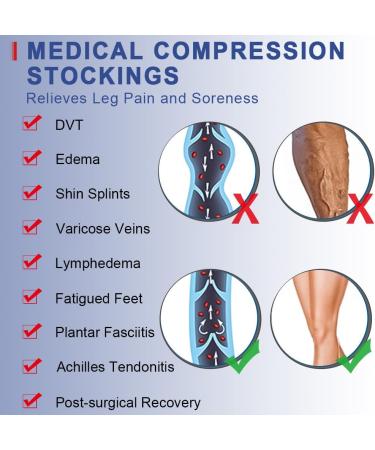 Beister 20-30 mmHg Medical Compression Stockings for Men & Women - Closed Toe Support Stockings for Varicose Veins & Edema - Black 3X Large - Buy Online on GoSupps.com