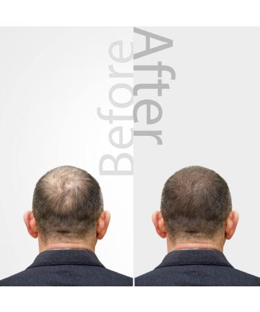 The Mossi London Hair Growth Oil Serum Scalp oil Hair Growth Complex with Vitamin E Dry Scalp Treatment for Hair Growth Healthy Skin Hair Growth ... - Buy Online on GoSupps.com