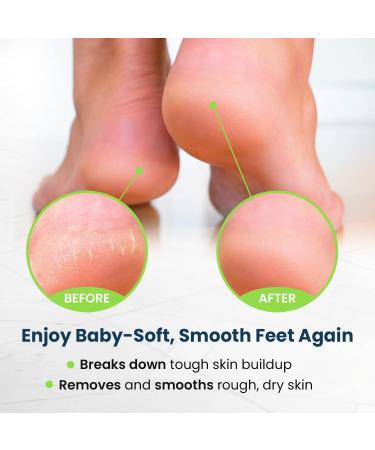 Extra Strength Toenail Fungus Treatment Kit - Foot Soak, Nail Repair Pen, Tea Tree Balm - Made in USA - Effective Solution for Smelly Feet, Athletes Foot, Cracked Nails - Buy Online on GoSupps.com