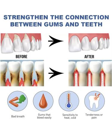 GNHG 3 Pieces Periodontal Treatment Free Smile Gingival Gel Instant Gum Treatment And Recovery - Buy Online on GoSupps.com