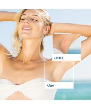 Shave Razor Bump & Ingrown Hair Aftershave Treatment Lotion - Sensitive Skin Care for Men & Women | Upgraded Formula 1.3 Fl Oz - Buy Online on GoSupps.com