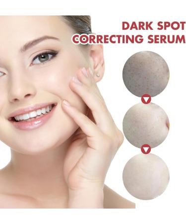  2Pcs Dark Spot Correcting Serum 10% Niacinamide+ 4% Tranexamic Acid Serum Ceramide Hyaluronic Acid Vitamin B12 natural color for Sensitive skin Fragrance-Free For Women Skin Care Serum 30ml/1fl.oz - Buy Online on GoSupps.com