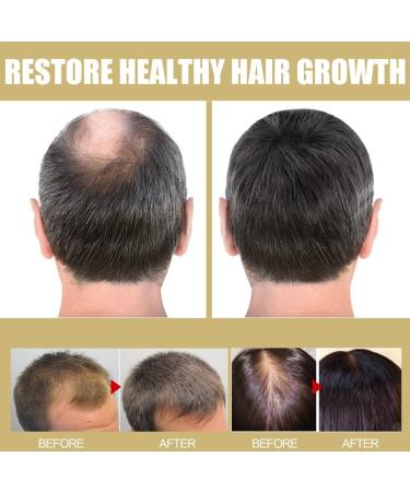 Giwnhvx Frizz-Free Hair Hat Thickening Hat Hair Care Supplies for Moisturizing and Repairing Damaged Dry Frizzy Hair Blue - Buy Online on GoSupps.com