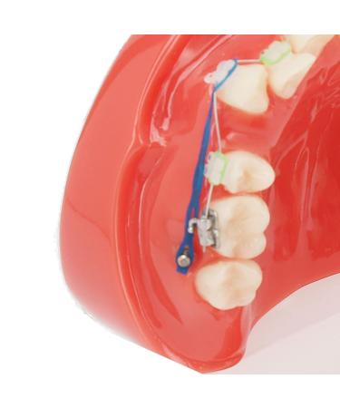 Buy GFRGFH Dental Model with 24 Teeth - Half Metal Half Ceramic Bracket for Teaching & Study - International Shipping Available - Buy Online on GoSupps.com