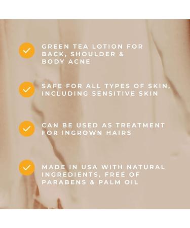 Ayadara Anti-Acne Treatment Body Lotion with Salicylic Acid & Tea Tree - 75-Day Supply | For Chest, Arm, Shoulder, Thigh, Butt & Back Acne in Women, Men & Teens - Buy Online on GoSupps.com