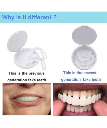 Zhirceke Teeth Veneers - Upper & Lower Dental Fixation for a Perfect Smile | Quick & Beautiful Results for All Sizes - Buy Online on GoSupps.com
