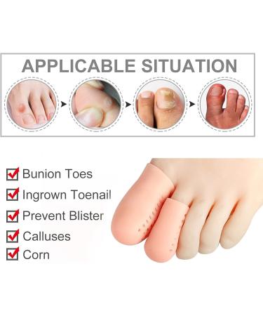 16-Piece Gel Toe Cushion Set | Breathable Toe Protectors for Ingrown Toenails Blisters & Calluses - International Shipping - Buy Online on GoSupps.com