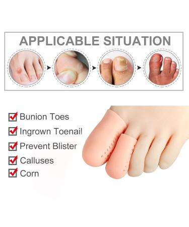Shop Sonew 16-Piece Silicone Toe Protection Caps - Breathable Gel Covers for Ingrown Toenails & Foot Comfort | International Shipping Available - Buy Online on GoSupps.com